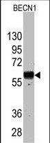 WB - Beclin 1 Antibody (Ascites) AM1818a